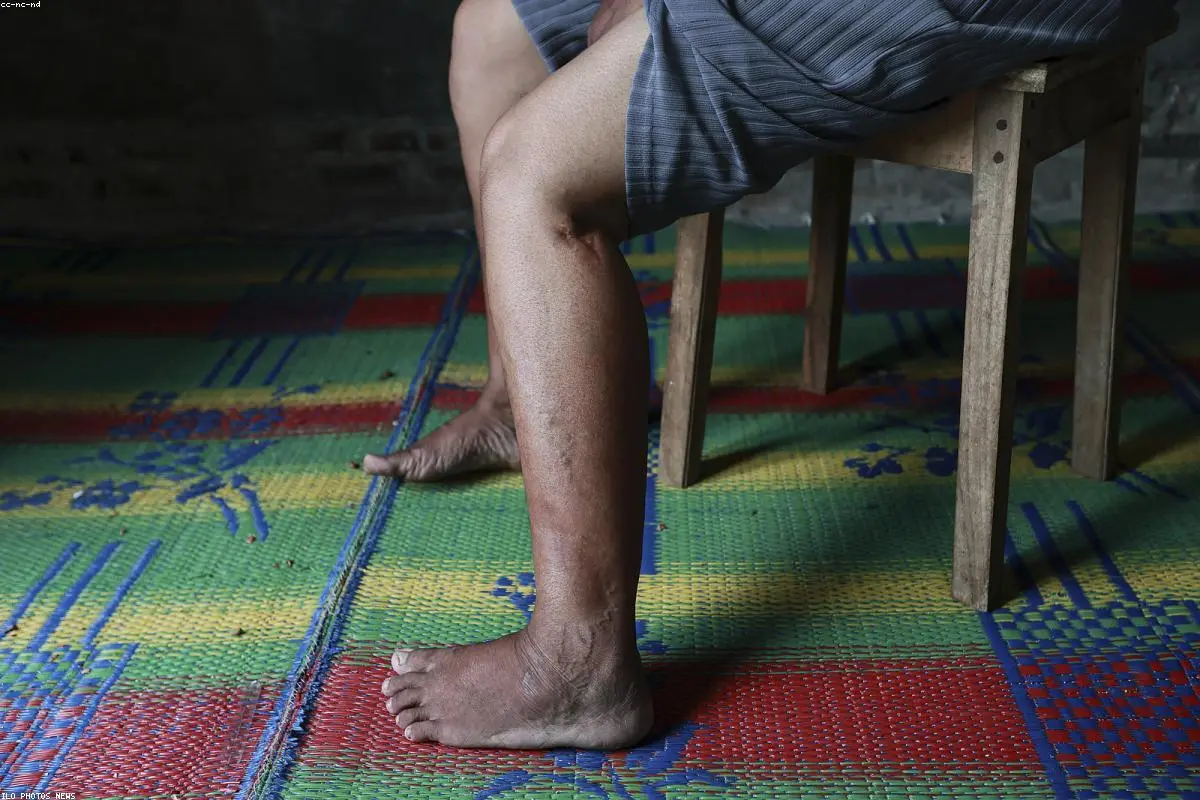 Stuck in Limbo: Inside the Northern France Camps as a New Migrant Deal Takes Shape